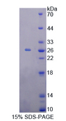 Recoverin Protein - Recombinant  Recoverin By SDS-PAGE