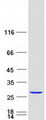 Recoverin Protein - Purified recombinant protein RCVRN was analyzed by SDS-PAGE gel and Coomassie Blue Staining