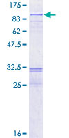 RECQ1 / RECQL Protein - 12.5% SDS-PAGE of human RECQL stained with Coomassie Blue