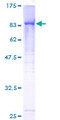 RECQL4 Protein - 12.5% SDS-PAGE of human RECQL4 stained with Coomassie Blue