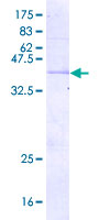 REDD-2 / DDIT4L Protein - 12.5% SDS-PAGE of human DDIT4L stained with Coomassie Blue