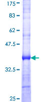 REDD-2 / DDIT4L Protein - 12.5% SDS-PAGE Stained with Coomassie Blue.