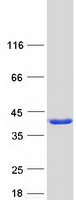 REEP2 Protein - Purified recombinant protein REEP2 was analyzed by SDS-PAGE gel and Coomassie Blue Staining