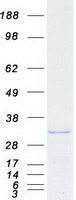 REEP3 Protein - Purified recombinant protein REEP3 was analyzed by SDS-PAGE gel and Coomassie Blue Staining