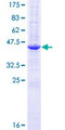 REEP5 Protein - 12.5% SDS-PAGE of human REEP5 stained with Coomassie Blue