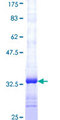 REEP5 Protein - 12.5% SDS-PAGE Stained with Coomassie Blue