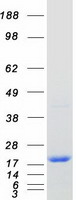 REEP5 Protein - Purified recombinant protein REEP5 was analyzed by SDS-PAGE gel and Coomassie Blue Staining