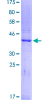 REG1A Protein - 12.5% SDS-PAGE of human REG1A stained with Coomassie Blue