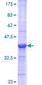 REG1A Protein - 12.5% SDS-PAGE Stained with Coomassie Blue.