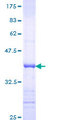REG1A Protein - 12.5% SDS-PAGE Stained with Coomassie Blue.