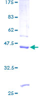 REG1B Protein - 12.5% SDS-PAGE of human REG1B stained with Coomassie Blue