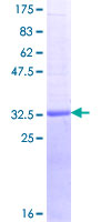 REG1B Protein - 12.5% SDS-PAGE Stained with Coomassie Blue.