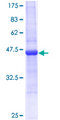 REG3A Protein - 12.5% SDS-PAGE of human REG3A stained with Coomassie Blue