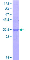REG3A Protein - 12.5% SDS-PAGE Stained with Coomassie Blue.