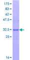 REG3A Protein - 12.5% SDS-PAGE Stained with Coomassie Blue.