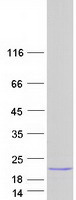 REG3A Protein - Purified recombinant protein REG3A was analyzed by SDS-PAGE gel and Coomassie Blue Staining
