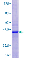 REG3G Protein - 12.5% SDS-PAGE of human REG3G stained with Coomassie Blue