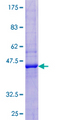 REG3G Protein - 12.5% SDS-PAGE of human REG3G stained with Coomassie Blue
