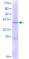 REG4 / REG-IV Protein - 12.5% SDS-PAGE of human REG4 stained with Coomassie Blue