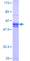 RELA / NFKB p65 Protein - 12.5% SDS-PAGE of human RELA stained with Coomassie Blue