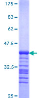 RELA / NFKB p65 Protein - 12.5% SDS-PAGE Stained with Coomassie Blue