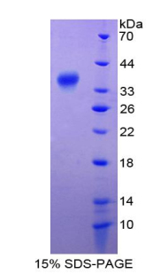 RELA / NFKB p65 Protein - Recombinant V-Rel Reticuloendotheliosis Viral Oncogene Homolog A By SDS-PAGE