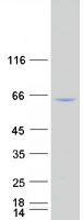 RELA / NFKB p65 Protein - Purified recombinant protein RELA was analyzed by SDS-PAGE gel and Coomassie Blue Staining