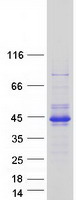 RELL2 Protein - Purified recombinant protein RELL2 was analyzed by SDS-PAGE gel and Coomassie Blue Staining