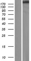 RELN / Reelin Protein - Western validation with an anti-DDK antibody * L: Control HEK293 lysate R: Over-expression lysate