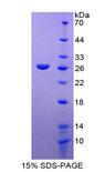RELN / Reelin Protein - Recombinant Reelin By SDS-PAGE