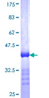REM1 / REM-1 Protein - 12.5% SDS-PAGE Stained with Coomassie Blue.