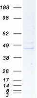 REM2 Protein - Purified recombinant protein REM2 was analyzed by SDS-PAGE gel and Coomassie Blue Staining