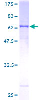 REN / Renin 1 Protein - 12.5% SDS-PAGE of human REN stained with Coomassie Blue