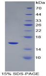 REN / Renin 1 Protein - Recombinant Renin By SDS-PAGE
