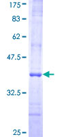 RENBP Protein - 12.5% SDS-PAGE Stained with Coomassie Blue