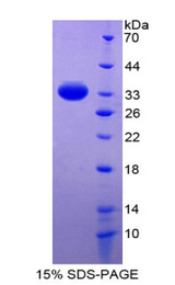 RENBP Protein - Recombinant Renin Binding Protein By SDS-PAGE