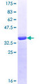 RENT1 / UPF1 Protein - 12.5% SDS-PAGE Stained with Coomassie Blue.