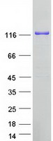 RENT1 / UPF1 Protein - Purified recombinant protein UPF1 was analyzed by SDS-PAGE gel and Coomassie Blue Staining