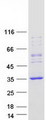 REP15 Protein - Purified recombinant protein REP15 was analyzed by SDS-PAGE gel and Coomassie Blue Staining