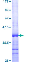 REPIN1 Protein - 12.5% SDS-PAGE Stained with Coomassie Blue.