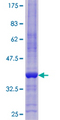 REPRIMO / RPRM Protein - 12.5% SDS-PAGE of human RPRM stained with Coomassie Blue