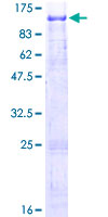REPS1 Protein - 12.5% SDS-PAGE of human REPS1 stained with Coomassie Blue