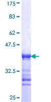 REPS2 Protein - 12.5% SDS-PAGE Stained with Coomassie Blue.