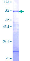 Requiem / DPF2 Protein - 12.5% SDS-PAGE of human DPF2 stained with Coomassie Blue
