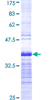 Requiem / DPF2 Protein - 12.5% SDS-PAGE Stained with Coomassie Blue.