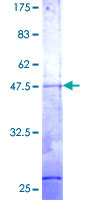 RER1 Protein - 12.5% SDS-PAGE of human RER1 stained with Coomassie Blue