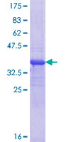 RERE Protein - 12.5% SDS-PAGE Stained with Coomassie Blue.