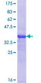 RERE Protein - 12.5% SDS-PAGE Stained with Coomassie Blue.