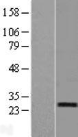 RERG Protein - Western validation with an anti-DDK antibody * L: Control HEK293 lysate R: Over-expression lysate