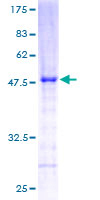 RERG Protein - 12.5% SDS-PAGE of human RERG stained with Coomassie Blue
